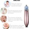 Face Vacuum - Image 2